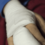 copii răniți de petarde