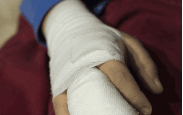 copii răniți de petarde