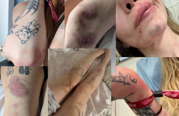 Cum apără Poliția Capitalei polițiștii acuzați că au bătut o femeie în secție